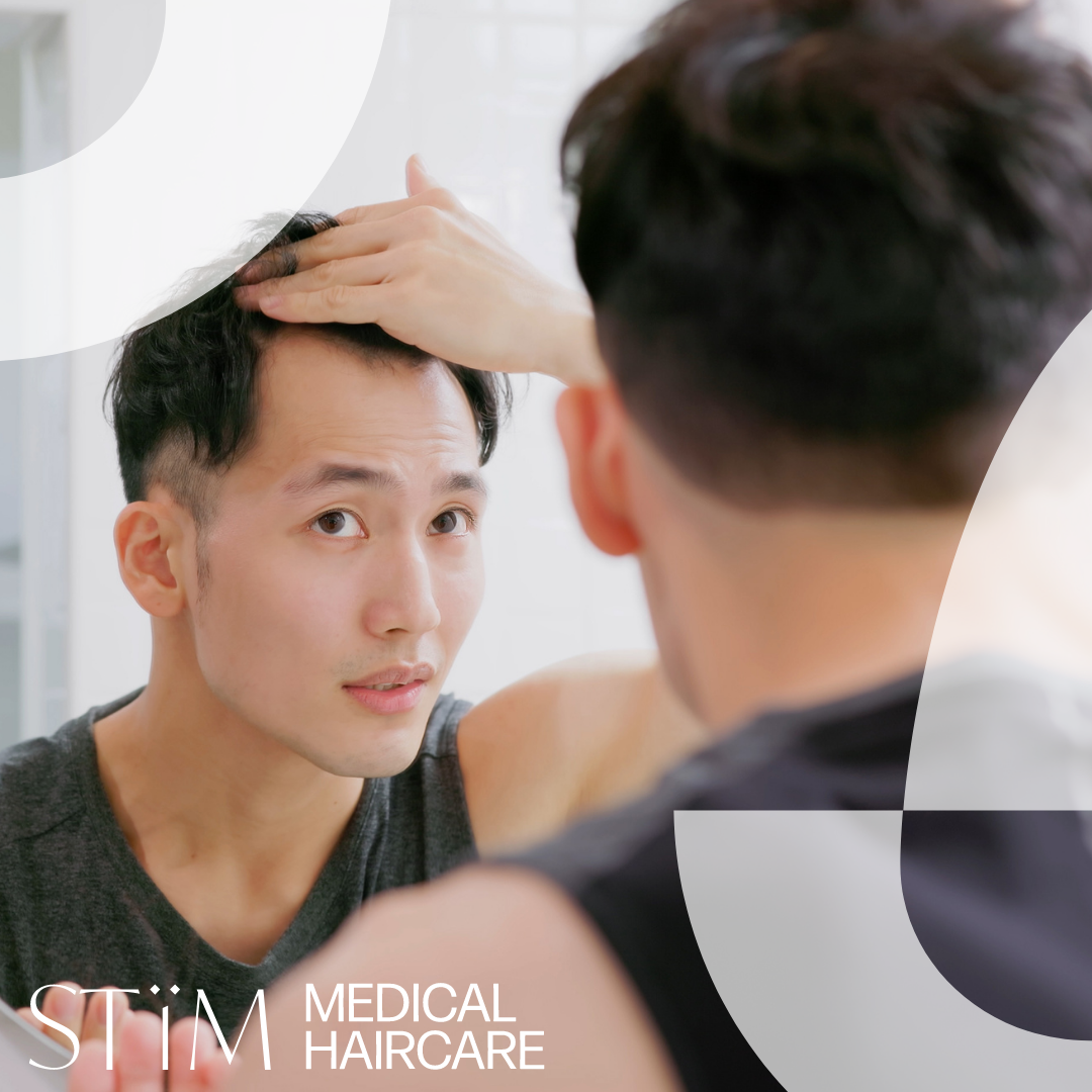 Why Is My Hair Falling Out: 8 Causes and How to Stop It