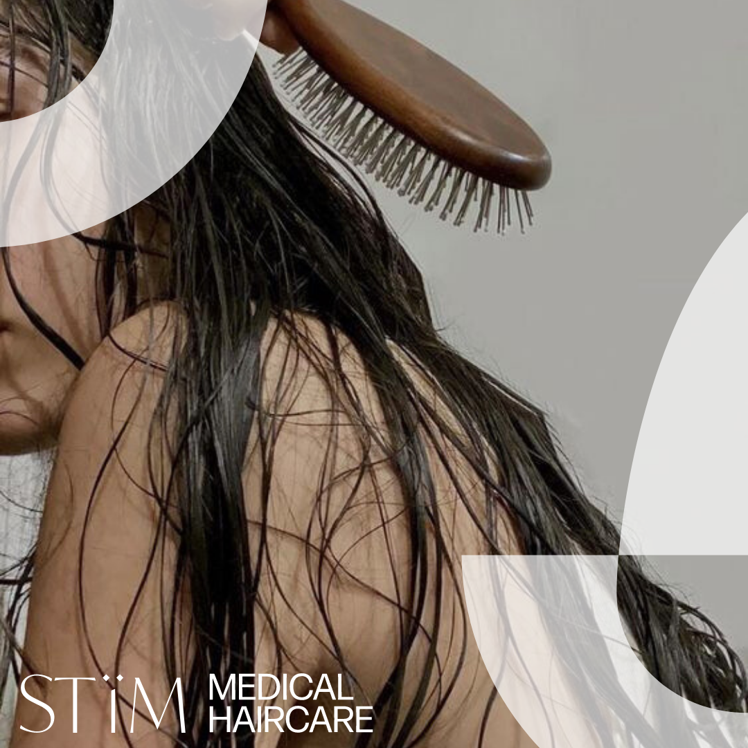 How to Prevent Hair Loss and Regrow Hair Naturally
