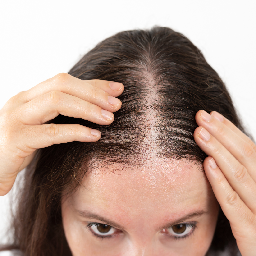 Why Scalp Health is the Key to Hair Growth