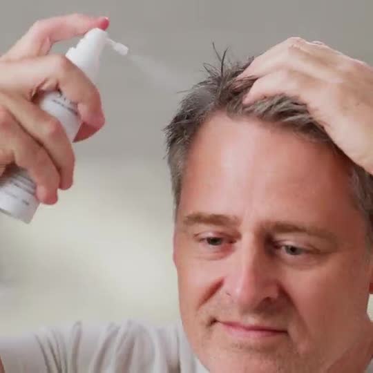 Man spraying Growth Tonic onto his hairline